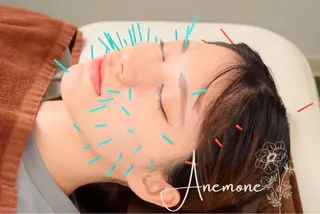 美容鍼・整体サロン アネモネ🌸心斎橋のエステ・リラクイメージ