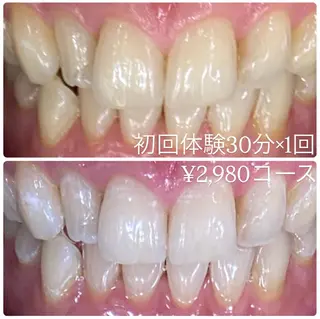 PLATINUM Beauty 横浜店所属・ホワイトニングルーム 横浜店のその他イメージ