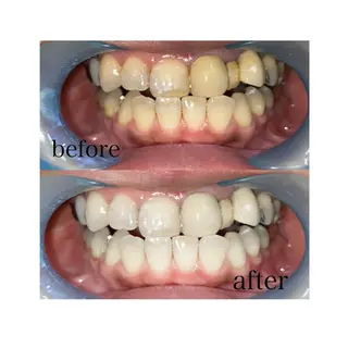 メンズ ホワイトニングサロン SHILONのエステ・リラクイメージ