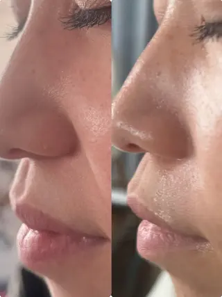 辻 有希音のエステ・リラクイメージ