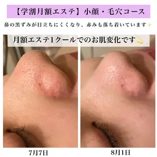 Bellesthe （ベルエステ）のエステ・リラクイメージ