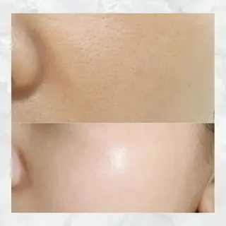 愛維美水光美肌専門店所属・愛維美水光美肌専門店 メンズレディースokのエステ・リラクイメージ