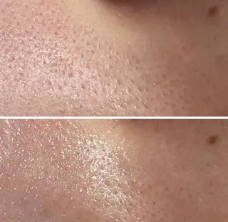 ADDICT中目黒店所属・毛穴洗浄/毛穴ケア 🌿中目黒🌿のエステ・リラクイメージ