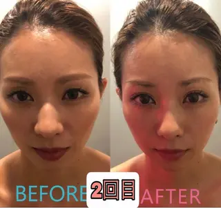 美容鍼灸サロン mahoroba院長のエステ・リラクイメージ