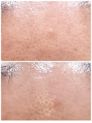 バストアップ専門/デ トックス/小顔コルギのエステ・リラクイメージ