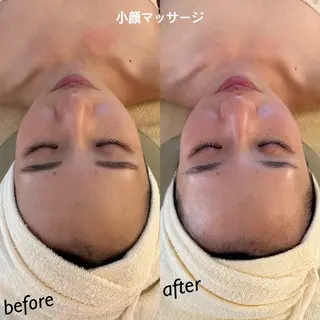 うなじ脱毛/美肌脱毛 LABELのエステ・リラクイメージ