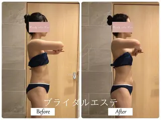 ブライダルサロン ｜Lino【堀江】のエステ・リラクイメージ