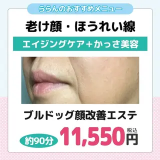 若返り 美肌   エステサロンららんのエステ・リラクイメージ