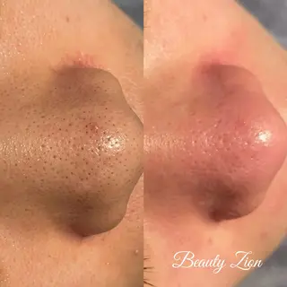 Beauty Zion所属・Beauty Zionのエステ・リラクイメージ