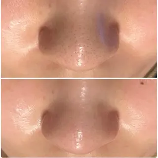 美容マッサージ Urichのエステ・リラクイメージ