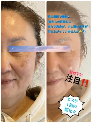 フェイシャルサロン ビアンカガーデンのエステ・リラクイメージ