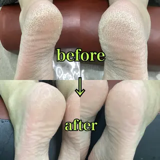 ヒューマン 鍼灸接骨院所属・リラク/ネイル/ 足裏ケア/蛭川栞のエステ・リラクイメージ