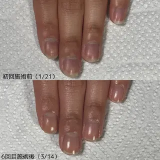 ネイル nail 1623のネイルデザイン