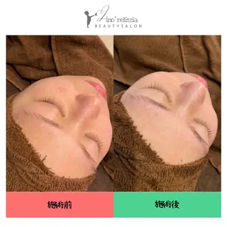 リノレリチア 新町店のエステ・リラクイメージ