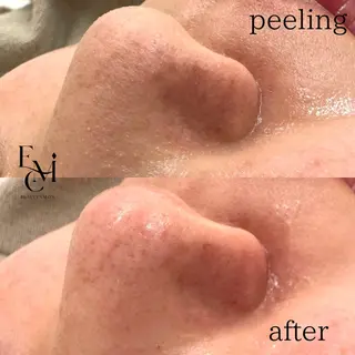 EMILUCA 伊藤のエステ・リラクイメージ