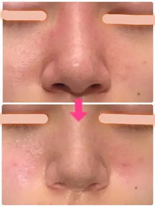 ロング カラー パーマ ヘアアレンジ メンズ キッズ ネイル マツエク・マツパ ‍痩身＆ボディ 結果出し🌟丹野のエステ・リラクイメージ