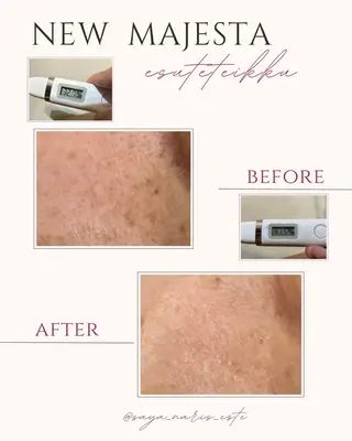 skinLabo所属・saya Mのエステ・リラクイメージ