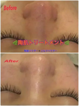 【リベルハーブピーリング認定店】敏感肌・美白脱毛専門店Dione立川店所属・Dione 立川店のエステ・リラクイメージ