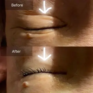 Mandarin Orange所属・毛穴から始める肌メン テマンダリンオレンジのエステ・リラクイメージ