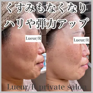 大久保 里奈のエステ・リラクイメージ