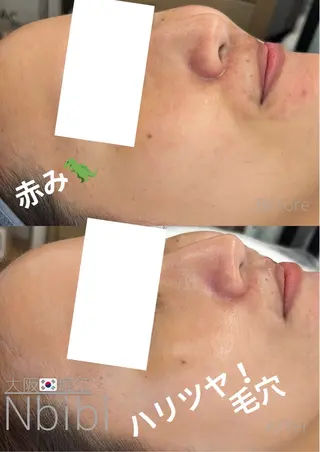 韓国🇰🇷価格 サロン_Nbibiのエステ・リラクイメージ