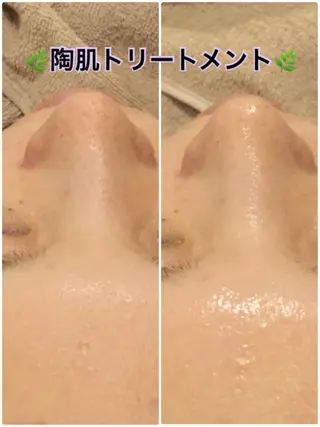 【リベルハーブピーリング認定店】敏感肌・美白脱毛専門店Dione立川店所属・Dione 立川店のエステ・リラクイメージ