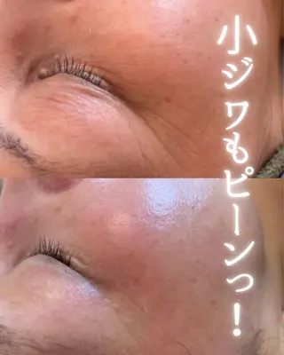 private beauty salon Lilby所属・リルビー 肌育・肌質改善サロンのその他イメージ