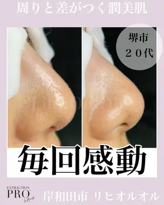 毛穴汚れ改善専門店/ 岸和田/リヒオルオルのエステ・リラクイメージ