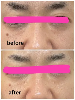 デアイム甲府所属・つかだ りょうこのエステ・リラクイメージ