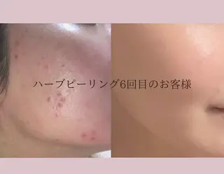 美肌ケアサロン iru【アイル】のエステ・リラクイメージ