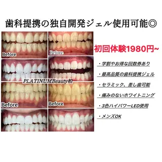 プラチナムビューティー柏所属・【歯科提携】柏ホワイ トニングスタイルのその他イメージ