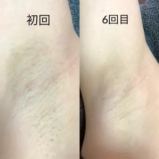 TWINKLE上尾店 Shimadaのエステ・リラクイメージ