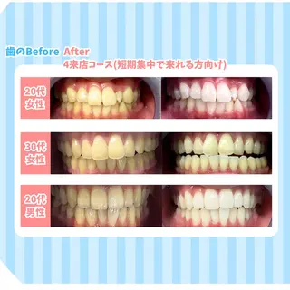 セルフホワイトニング Dolce水戸店のその他イメージ