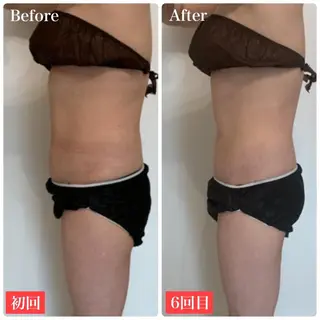 ララ/ハーブ メゾンリュバンのエステ・リラクイメージ