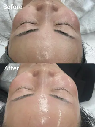 小顔専門看護師クリニカルサロンCOCO所属・小顔と美肌サロン クリニカルサロンココのエステ・リラクイメージ