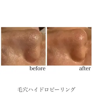 脱毛&エステサロン JIGGLY武蔵小山のエステ・リラクイメージ