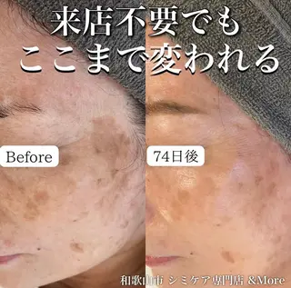 シミケア専門店 &More所属・シミケア専門店 &Moreのエステ・リラクイメージ