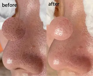 韓国肌管理 【毛穴専科】のエステ・リラクイメージ