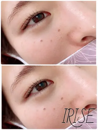 マツエク・マツパ salon de   irise所属・salon de iriseのマツエク・マツパデザイン