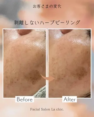 La chic.のエステ・リラクイメージ