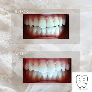 ホワイトニングサロン シロイハ所属・歯を白くしたい方🦷 シロイハのその他イメージ
