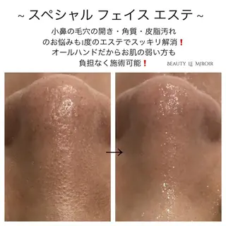 ビューティー ミロワールのエステ・リラクイメージ