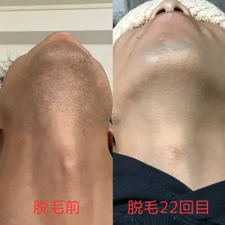 メンズ Beauty K's【ビューティーケイズ】所属・メンズ脱毛サロン ／金山昌弘のエステ・リラクイメージ