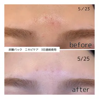 leolo武蔵浦和 肌質改善＆脱毛のエステ・リラクイメージ