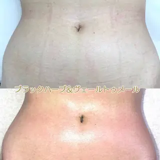 オールハンド フェイシャルのエステ・リラクイメージ