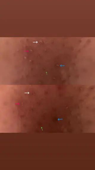 毛穴ケア/毛穴診断/ 毛穴洗浄〔心斎橋〕のエステ・リラクイメージ