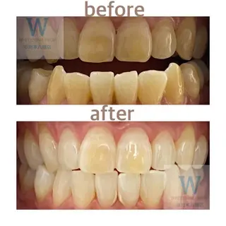 ホワイトニング ショップ本八幡店のエステ・リラクイメージ