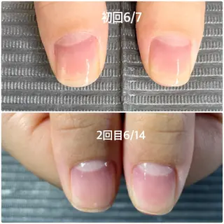 ネイル 奥園 良恵のネイルデザイン