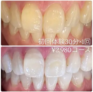 メンズ ホワイトニングルーム 川崎店所属・ホワイトニング ルーム 川崎店のその他イメージ