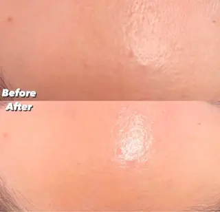 アイラッシュ&エステサロンLinda西宮所属・小顔&毛穴・肌質改善 LINDA西宮 AIのエステ・リラクイメージ